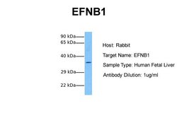 Invitrogen Ephrin B1 Polyclonal Antibody 100 &mu;L; Unconjugated:Antibodies,