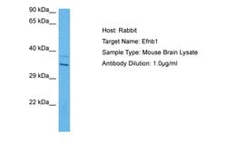 Invitrogen Ephrin B1 Polyclonal Antibody 100 &mu;L; Unconjugated:Antibodies,