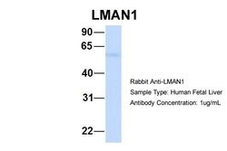 Invitrogen LMAN1 Polyclonal Antibody 100 &mu;L | Buy Online | Invitrogen&trade; | Fisher Scientific