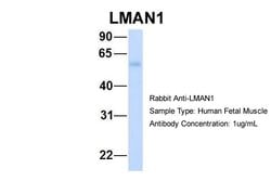 Invitrogen LMAN1 Polyclonal Antibody 100 &mu;L | Buy Online | Invitrogen&trade; | Fisher Scientific