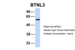 Invitrogen BTNL3 Polyclonal Antibody 100 μL; Unconjugated:Antibodies,