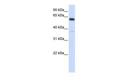 Invitrogen ALG6 Polyclonal Antibody 100 &mu;L; Unconjugated:Antibodies,