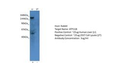 Invitrogen ATP11B Polyclonal Antibody 100 &mu;L; Unconjugated:Antibodies,