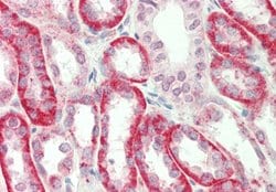 Invitrogen SV2A Polyclonal Antibody 100 &mu;L | Buy Online | Invitrogen&trade; | Fisher Scientific