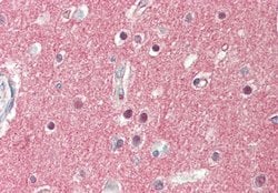 Invitrogen SV2A Polyclonal Antibody 100 &mu;L | Buy Online | Invitrogen&trade; | Fisher Scientific