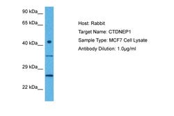 Invitrogen DULLARD Polyclonal Antibody 100 &mu;L; Unconjugated:Antibodies,