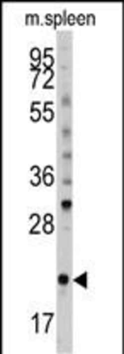 Invitrogen BID Polyclonal Antibody 400 &mu;L; Unconjugated:Antibodies,