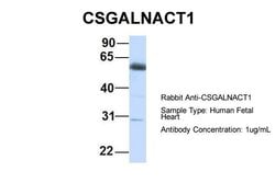 Invitrogen CSGALNACT1 Polyclonal Antibody 100 &mu;L; Unconjugated:Antibodies,