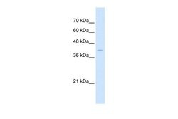 Invitrogen beta-Arrestin 2 Polyclonal Antibody 100 &mu;L; Unconjugated:Antibodies,