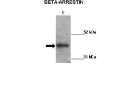 Invitrogen beta-Arrestin 2 Polyclonal Antibody 100 &mu;L; Unconjugated:Antibodies,