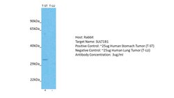 Invitrogen SULT1B1 Polyclonal Antibody 100 μL; Unconjugated:Antibodies,