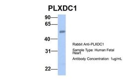 Invitrogen TEM7 Polyclonal Antibody 100 &mu;L; Unconjugated:Antibodies,