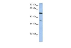Invitrogen TEM7 Polyclonal Antibody 100 &mu;L; Unconjugated:Antibodies,