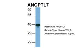 Invitrogen ANGPTL7 Polyclonal Antibody 100 &mu;L; Unconjugated:Antibodies,