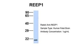 Invitrogen REEP1 Polyclonal Antibody 100 &mu;L; Unconjugated:Antibodies,