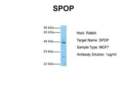 Invitrogen SPOP Polyclonal Antibody 100 μL; Unconjugated:Antibodies,