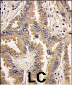Invitrogen BAD Polyclonal Antibody 400 &mu;L; Unconjugated:Antibodies,