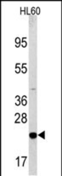 Invitrogen BAD Polyclonal Antibody 400 &mu;L; Unconjugated:Antibodies,
