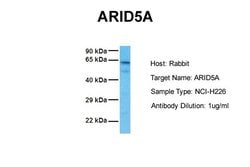 Invitrogen ARID5A Polyclonal Antibody 100 &mu;L; Unconjugated:Antibodies,