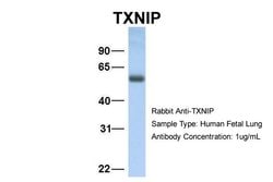 Invitrogen TXNIP Polyclonal Antibody 100 &mu;L; Unconjugated:Antibodies,