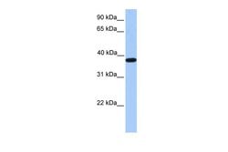 Invitrogen ACTRT2 Polyclonal Antibody 100 &mu;L; Unconjugated:Antibodies,