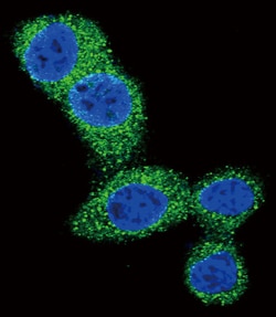 Invitrogen PUMA alpha Polyclonal Antibody 400 &mu;L; Unconjugated:Antibodies,