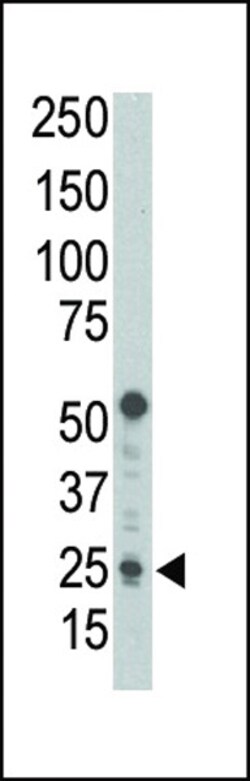 Invitrogen PUMA alpha Polyclonal Antibody 400 &mu;L; Unconjugated:Antibodies,