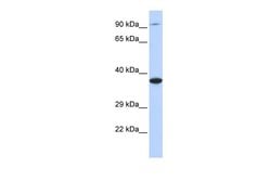 Invitrogen BBS5 Polyclonal Antibody 100 &mu;L; Unconjugated:Antibodies,