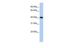 Invitrogen Clavesin-1 Polyclonal Antibody 100 &mu;L | Buy Online | Invitrogen&trade; | Fisher Scientific