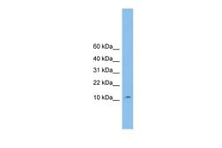 Invitrogen CHCHD1 Polyclonal Antibody 100 μL; Unconjugated:Antibodies,