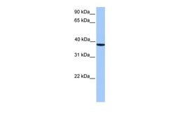 Invitrogen CK2 alpha-2 Polyclonal Antibody 100 &mu;L | Buy Online | Invitrogen&trade; | Fisher Scientific