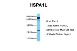 Invitrogen HSP701L Polyclonal Antibody 100 μL; Unconjugated:Antibodies,
