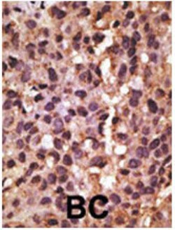 Invitrogen BNIP3 Polyclonal Antibody 400 &mu;L; Unconjugated:Antibodies,