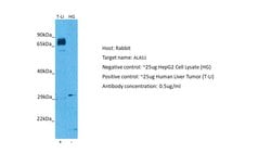 Invitrogen ALAS1 Polyclonal Antibody 100 &mu;L; Unconjugated:Antibodies,