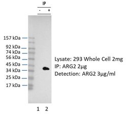 Invitrogen Arginase 2 Polyclonal Antibody 100 μL; Unconjugated:Antibodies,