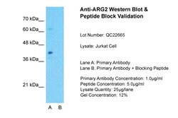 Invitrogen Arginase 2 Polyclonal Antibody 100 μL; Unconjugated:Antibodies,