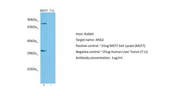Invitrogen Arginase 2 Polyclonal Antibody 100 μL; Unconjugated:Antibodies,