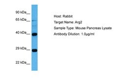 Invitrogen Arginase 2 Polyclonal Antibody 100 μL; Unconjugated:Antibodies,