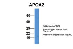 Invitrogen ApoA2 Polyclonal Antibody 100 &mu;L; Unconjugated:Antibodies,