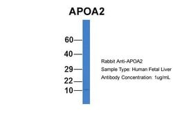 Invitrogen ApoA2 Polyclonal Antibody 100 &mu;L; Unconjugated:Antibodies,