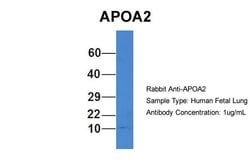Invitrogen ApoA2 Polyclonal Antibody 100 &mu;L; Unconjugated:Antibodies,