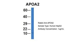 Invitrogen ApoA2 Polyclonal Antibody 100 &mu;L; Unconjugated:Antibodies,