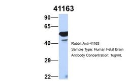 Invitrogen SEPT11 Polyclonal Antibody 100 &mu;L; Unconjugated:Antibodies,