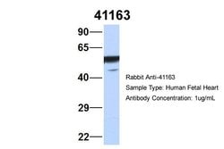 Invitrogen SEPT11 Polyclonal Antibody 100 &mu;L; Unconjugated:Antibodies,