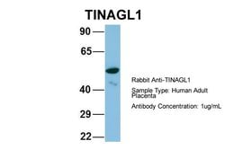Invitrogen TINAGL1 Polyclonal Antibody 100 &mu;L; Unconjugated:Antibodies,