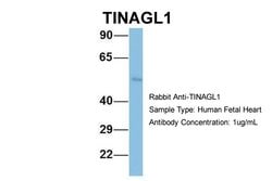 Invitrogen TINAGL1 Polyclonal Antibody 100 &mu;L; Unconjugated:Antibodies,