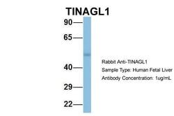 Invitrogen TINAGL1 Polyclonal Antibody 100 &mu;L; Unconjugated:Antibodies,