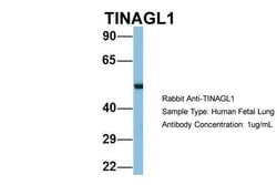 Invitrogen TINAGL1 Polyclonal Antibody 100 &mu;L; Unconjugated:Antibodies,
