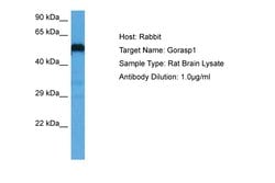 Invitrogen GRASP65 Polyclonal Antibody 100 &mu;L; Unconjugated:Antibodies,