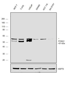 Invitrogen FOXA1 Polyclonal Antibody 100 μL; Unconjugated:Antibodies,